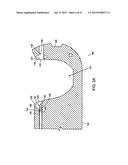 PLACING SUTURES diagram and image