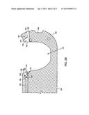 PLACING SUTURES diagram and image