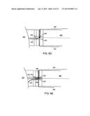 PLACING SUTURES diagram and image