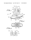 VASCULAR HOLE CLOSURE DEVICE diagram and image