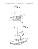 VASCULAR HOLE CLOSURE DEVICE diagram and image