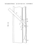 SURGICALLY CLOSING PERCUTANEOUSLY PUNCTURES diagram and image