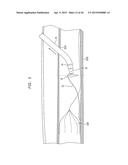 SURGICALLY CLOSING PERCUTANEOUSLY PUNCTURES diagram and image