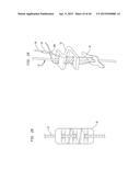 SURGICALLY CLOSING PERCUTANEOUSLY PUNCTURES diagram and image