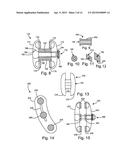 BONE PLATES, SCREWS AND INSTRUMENTS diagram and image