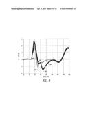 CARDIAC PACING WITH ANODAL STIMULATION DETECTION diagram and image