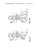 Method and Apparatus of Preventing a Fall or Minimizing the Impact of the     Fall of an Individual diagram and image