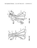 Method and Apparatus of Preventing a Fall or Minimizing the Impact of the     Fall of an Individual diagram and image