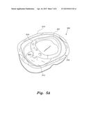 COMBINATION INFANT BATHTUB AND SEAT diagram and image