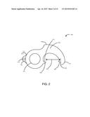 BEVERAGE-OPENING TOOL AND METHOD diagram and image