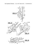 IMPLEMENT TOOTH ASSEMBLY WITH TIP AND ADAPTER diagram and image