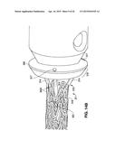 APPARATUS FOR COATING A STENT diagram and image