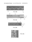 APPARATUS FOR COATING A STENT diagram and image