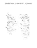 Systems, Devices, and Methods for Retaining Oral Devices for Airway     Treatment diagram and image