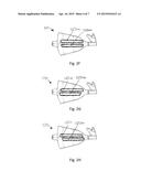 Systems, Devices, and Methods for Retaining Oral Devices for Airway     Treatment diagram and image