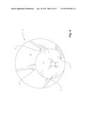 FEED DELIVERY SYSTEM FOR A FROTH SETTLING UNIT diagram and image