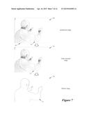 KEYER TOOL diagram and image