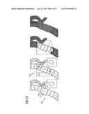 MODIFICATION OF A HOLLOW ORGAN REPRESENTATION diagram and image