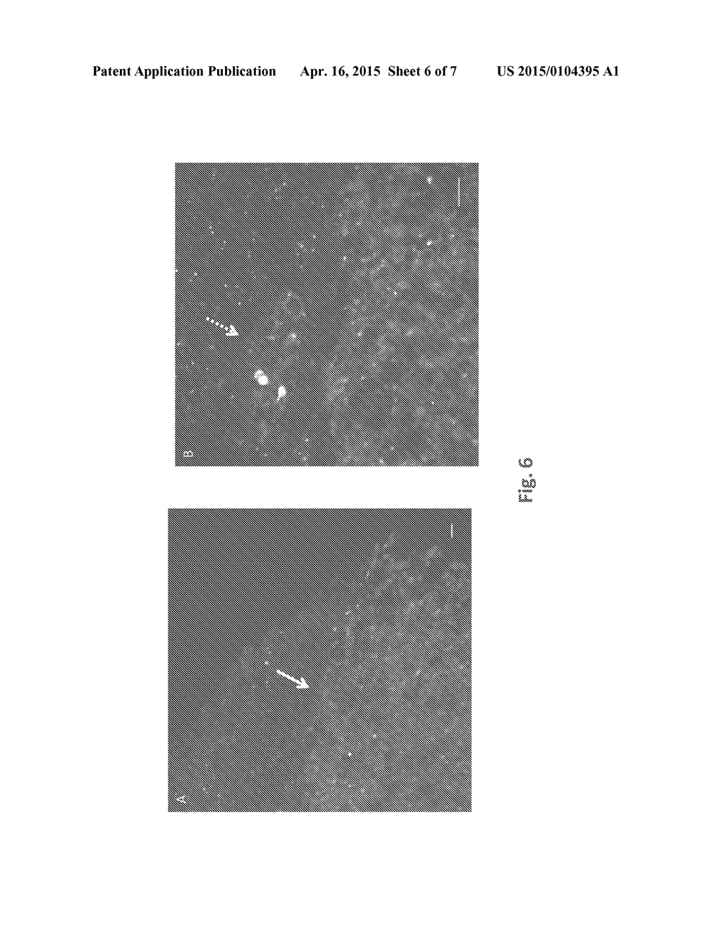 System and Method for Diagnosis of Astrocytic Brain Tumor - diagram, schematic, and image 07