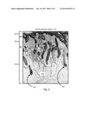 COMPLETE HUMAN SKIN ORGAN GENERATED FROM CULTURE-EXPANDED CELLS diagram and image