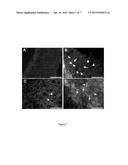 Methods of Inhibiting Gonad Maturation diagram and image