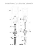 TEMPORARY ABUTMENT WITH COMBINATION OF SCANNING FEATURES AND     PROVISIONALIZATION FEATURES diagram and image