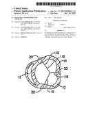 HEART WALL TENSION REDUCTION APPARATUS diagram and image