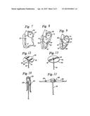 HEART WALL TENSION REDUCTION APPARATUS diagram and image