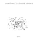 Endoscope Accessory diagram and image