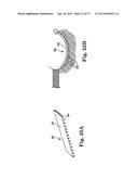 SYSTEMS, IMPLANTS, TOOLS, AND METHODS FOR TREATMENTS OF PELVIC CONDITIONS diagram and image