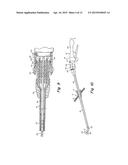 SURGICAL INSTRUMENT GUIDE DEVICE diagram and image