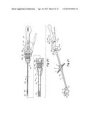 SURGICAL INSTRUMENT GUIDE DEVICE diagram and image