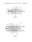 ENERGY DELIVERY DEVICE AND METHODS OF USE diagram and image