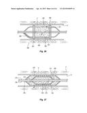 ENERGY DELIVERY DEVICE AND METHODS OF USE diagram and image