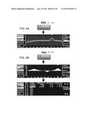 METHOD AND APPARATUS FOR ACQUIRING AND PROCESSING ACOUSTIC ENERGY EMITTED     BY AT LEAST ONE ORGAN IN A BIOLOGICAL SYSTEM diagram and image