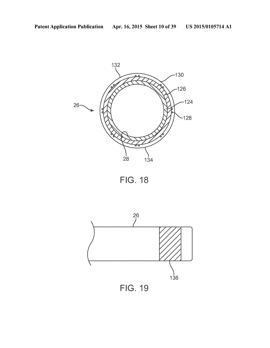 METHODS AND DEVICES FOR TREATMENT OF STENOSIS OF ARTERIOVENOUS FISTULA     SHUNTS - diagram, schematic, and image 11