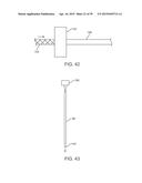 METHODS AND DEVICES FOR TREATMENT OF STENOSIS OF ARTERIOVENOUS FISTULA     SHUNTS diagram and image