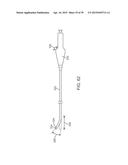 METHODS AND DEVICES FOR TREATMENT OF STENOSIS OF ARTERIOVENOUS FISTULA     SHUNTS diagram and image