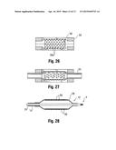 PARISON FOR FORMING BLOW MOLDED MEDICAL BALLOON WITH MODIFIED PORTION,     MEDICAL BALLOON, AND RELATED METHODS diagram and image