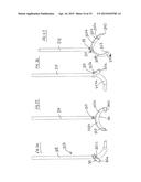 DEVICE FOR USE IN FACILITATING ALIGNMENT OF AN ACETABULAR COMPONENT diagram and image