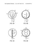 Deployable and Multi-Sectional Hearing Implant Electrode diagram and image