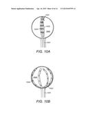 Deployable and Multi-Sectional Hearing Implant Electrode diagram and image