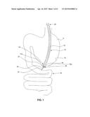 DEVICES FOR APPROXIMATING TISSUE AND RELATED METHODS OF USE diagram and image