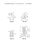 DEVICES FOR APPROXIMATING TISSUE AND RELATED METHODS OF USE diagram and image