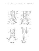 DEVICES FOR APPROXIMATING TISSUE AND RELATED METHODS OF USE diagram and image