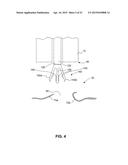 DEVICES FOR APPROXIMATING TISSUE AND RELATED METHODS OF USE diagram and image