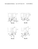 DEVICES FOR APPROXIMATING TISSUE AND RELATED METHODS OF USE diagram and image