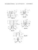 DEVICES FOR APPROXIMATING TISSUE AND RELATED METHODS OF USE diagram and image