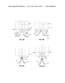 DEVICES FOR APPROXIMATING TISSUE AND RELATED METHODS OF USE diagram and image