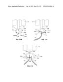 DEVICES FOR APPROXIMATING TISSUE AND RELATED METHODS OF USE diagram and image